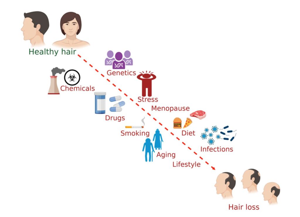 A comprehensive chart showing factors that affect hair health, comparing healthy hair on one side with various hair loss causes