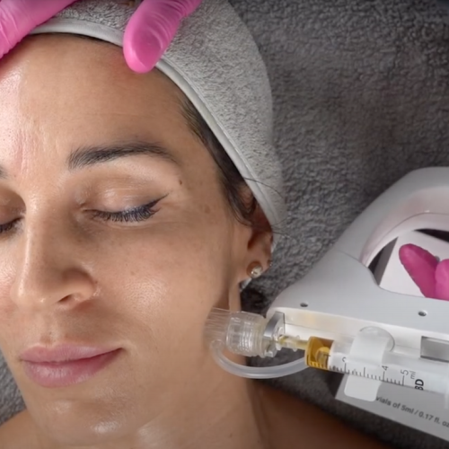 A woman with glowing skin receiving PRP skin mesotherapy treatment using the advanced Korean Crystal Meso injector at Glow Matrix. Represents precision, innovation, and professional skincare.